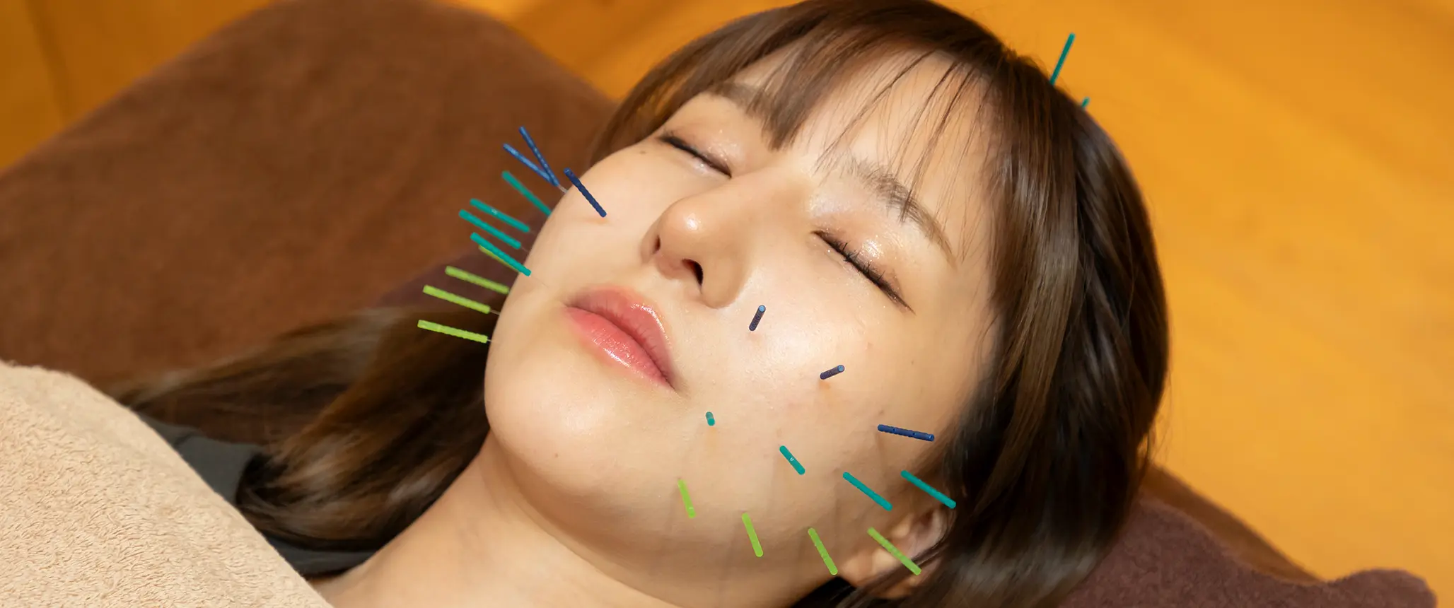 鍼
